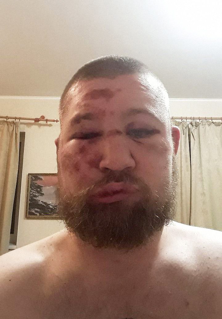 Ivan Beletsky after the attack