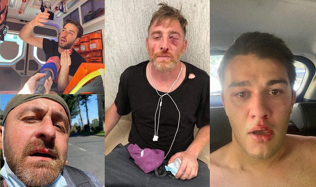 В Тбилиси жестко разогнали гей-прайд. Участников и журналистов избили при попустительстве правительства