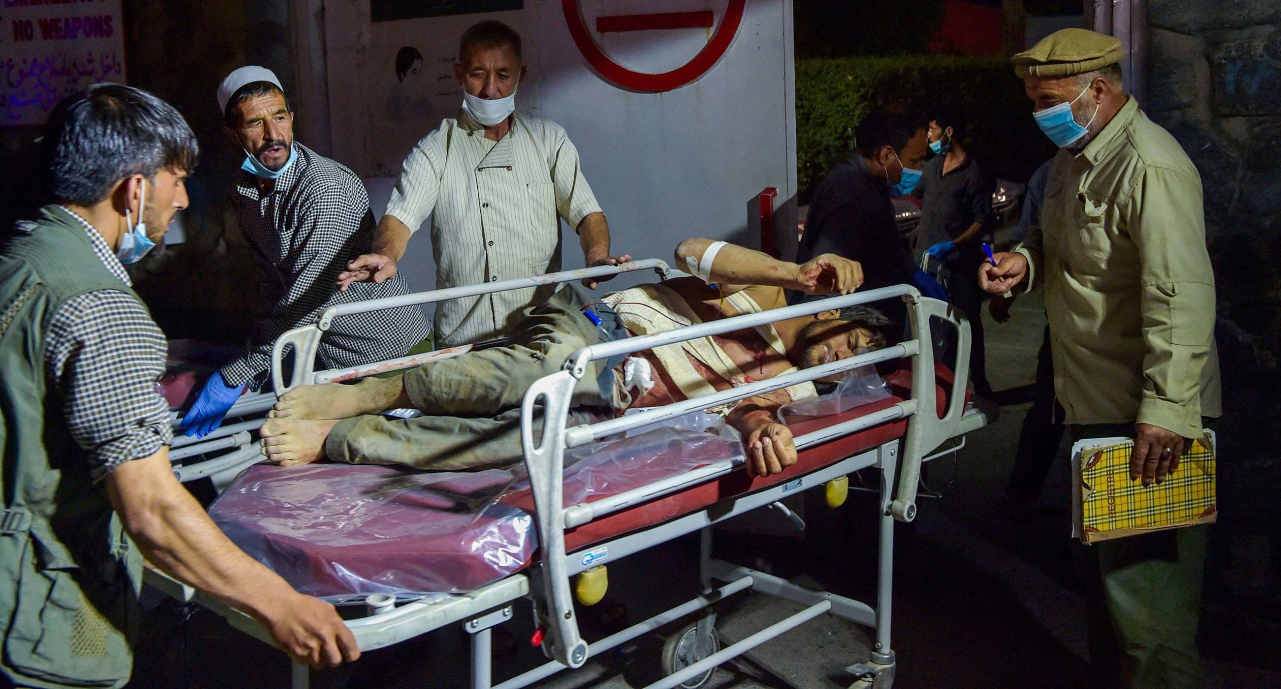 Раненый после взрыва возле аэропорта в Кабуле, 26 августа 2021